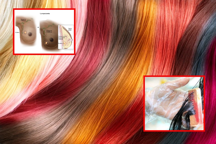 ¿El tinte aumenta el riesgo de cáncer de mama?