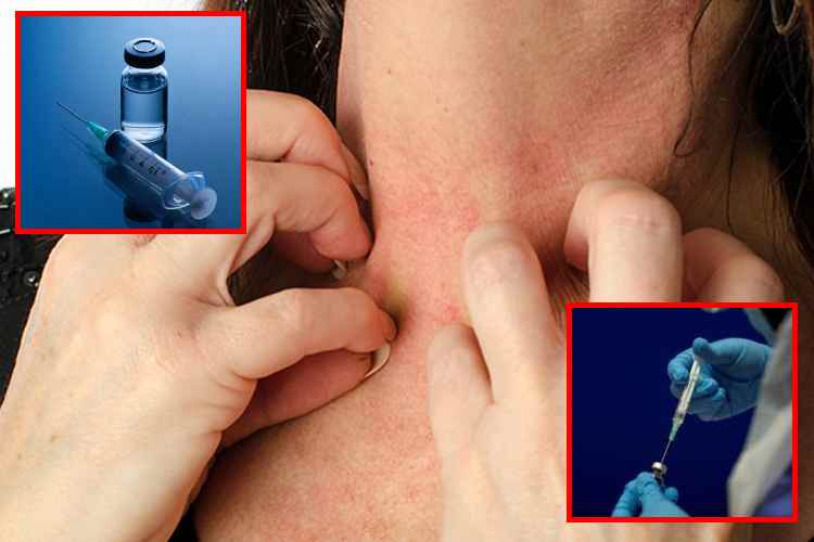 Vacuna experimental podría cambiar el tratamiento de las alergias graves