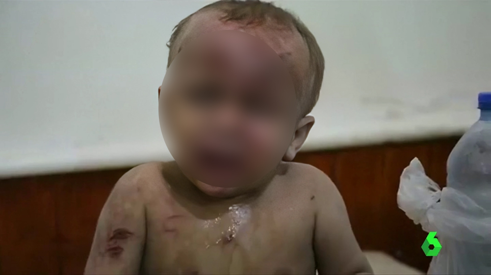 Le dieron un ‘balazo’ en la cabeza