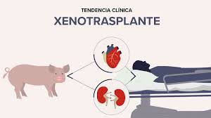 Los xenotransplantes