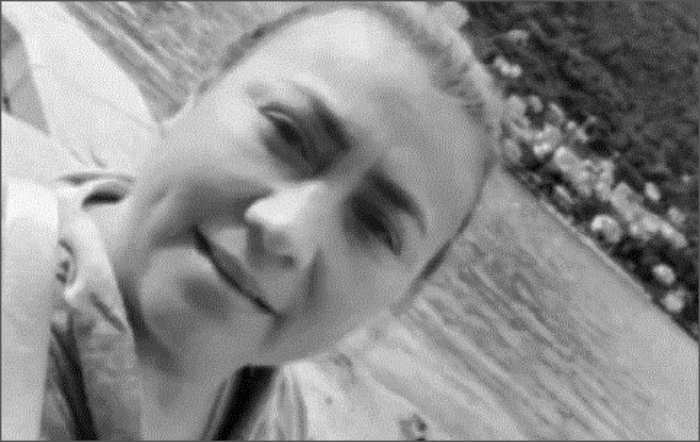 cirugĆa estĆ©tica- Medicina Legal- Yulixa Toloza - fracturas- necropsia- heridas- arma blanca-